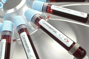 Este miércoles dieron a conocer tres casos de coronavirus
