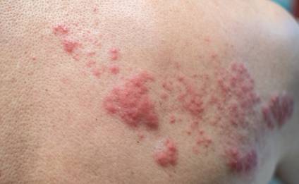 Enfermedades, desinversión y 