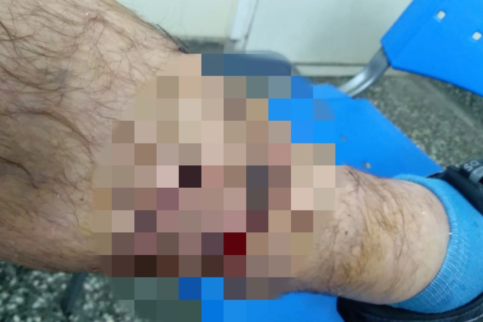 La herida fue suturada en el Hospital Regional.